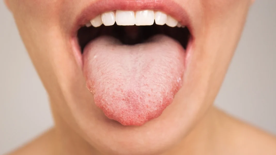 Your Mouth’s Hidden Secrets